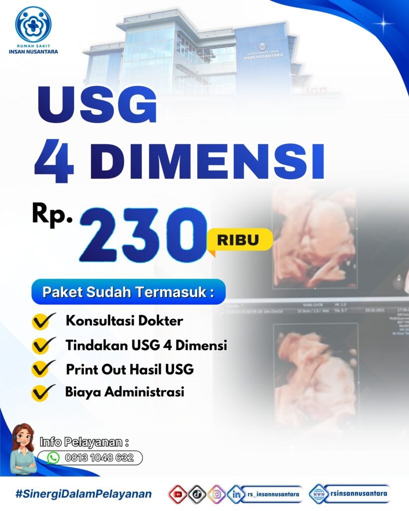 Promo USG